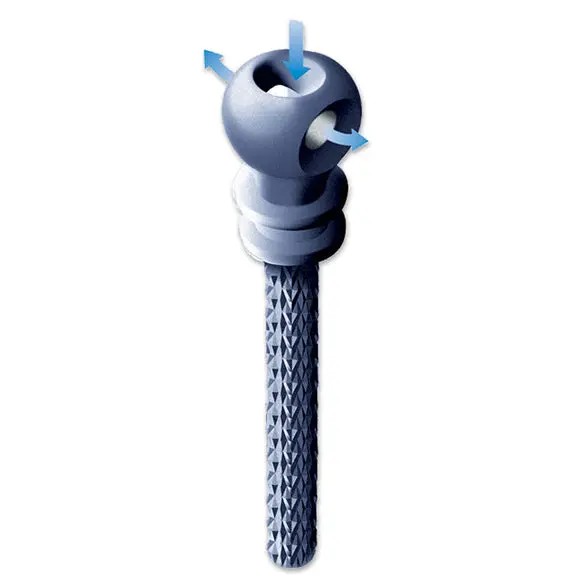 Integrapost #3 Titanium Alloy Posts, Package Of 10. #3001105 1